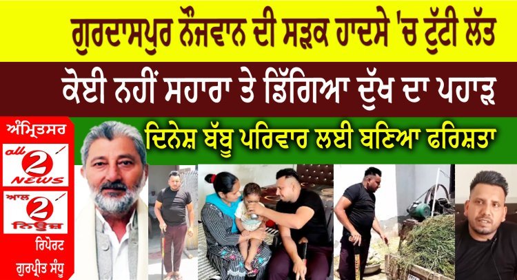 Gurdaspur youth leg broken in accident, Dinesh Babbu is angel said family, Dinesh Singh Babbu Help